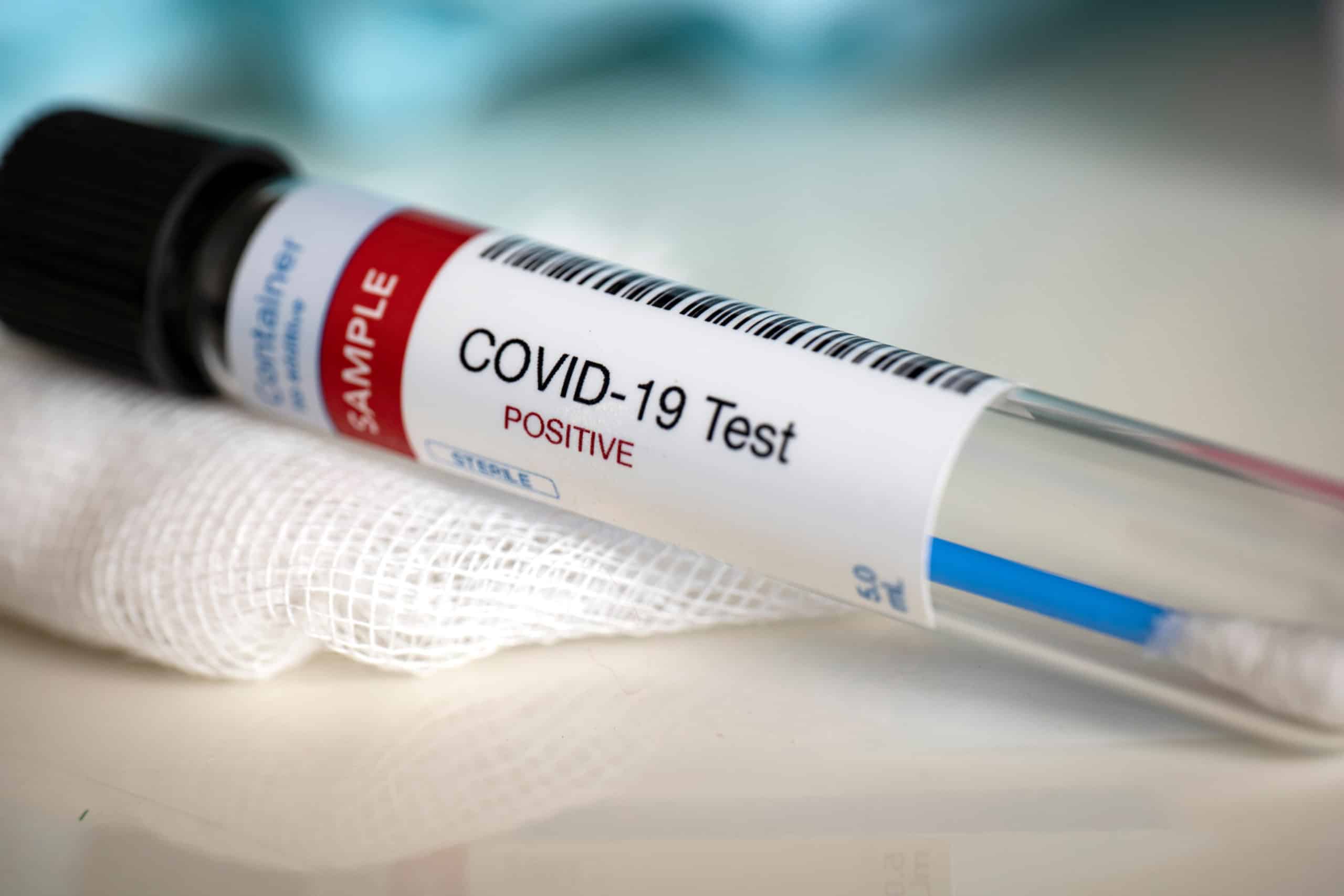 What to Do When an Employee Tests Positive for COVID-19